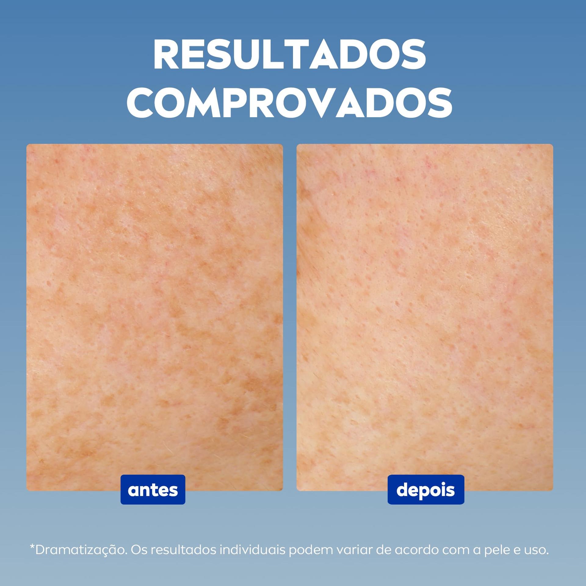 Sérum Facial Nivea Luminous 630, Antimarcas Escurecidas, 30ml